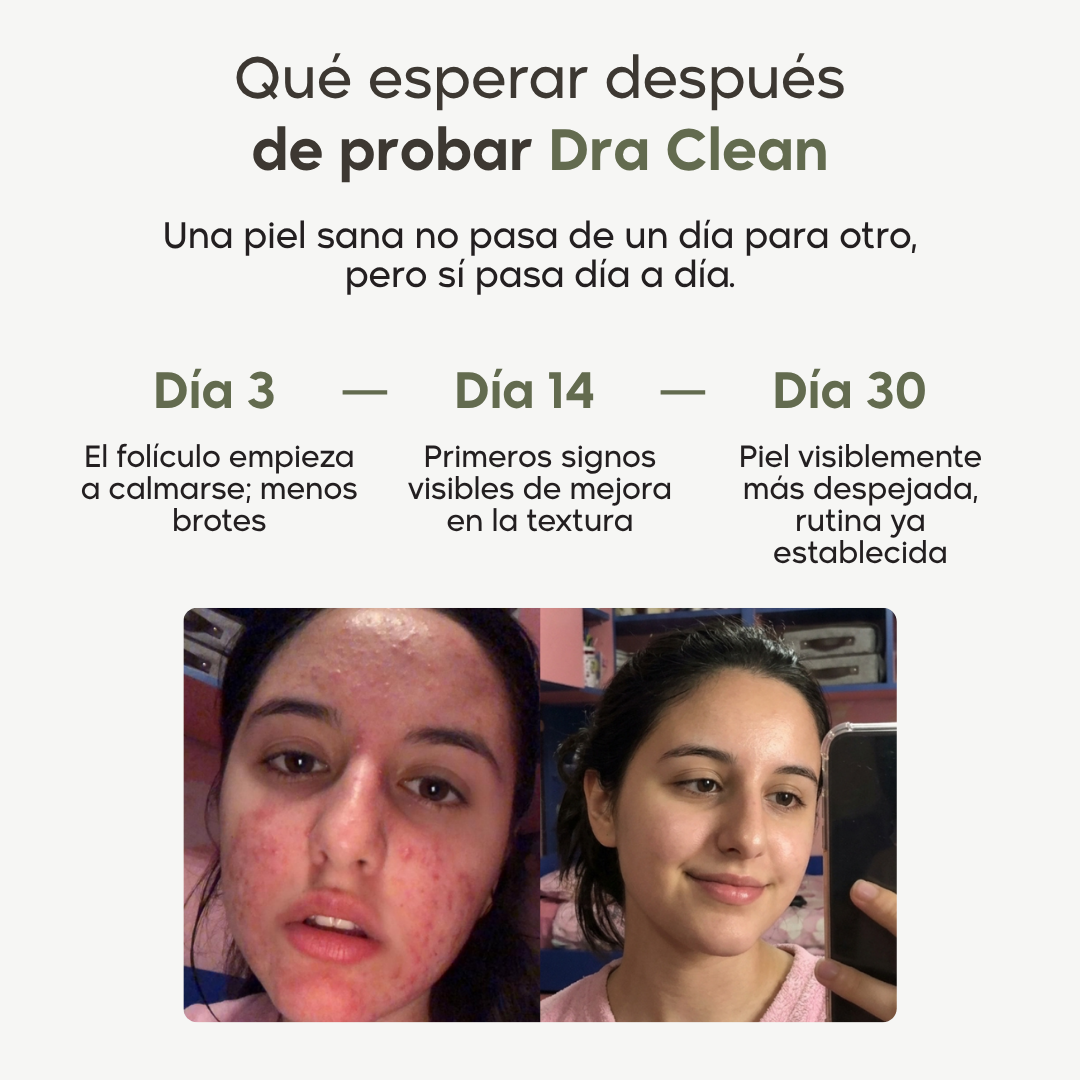 Protocolo antibrotes 360° | Por dentro y por fuera
